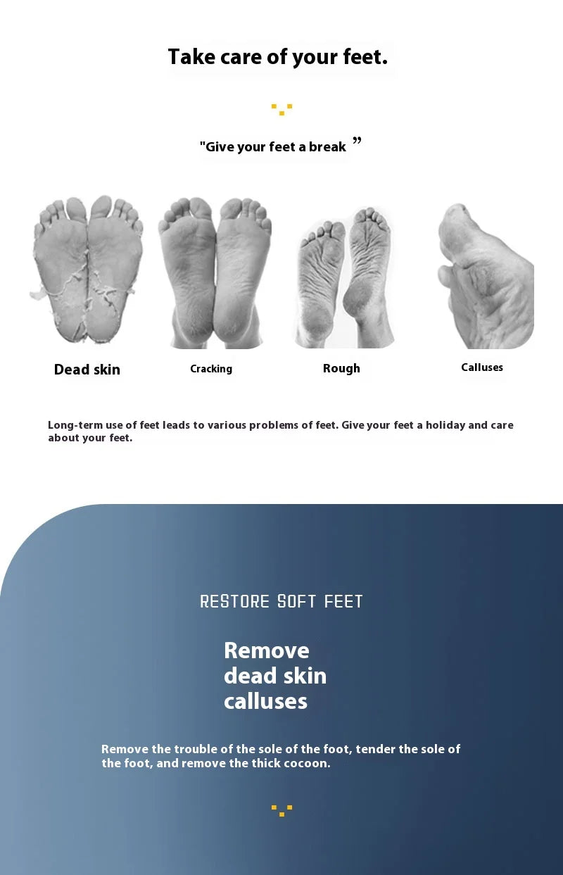 इलेक्ट्रिक फुट ग्राइन्डर, रिचार्जेबल खुट्टा मर्मत उपकरण, मृत छाला र कलस पालिस गर्ने मेसिन, एक्सफोलिएटिंग पालिस गर्ने मेसिन