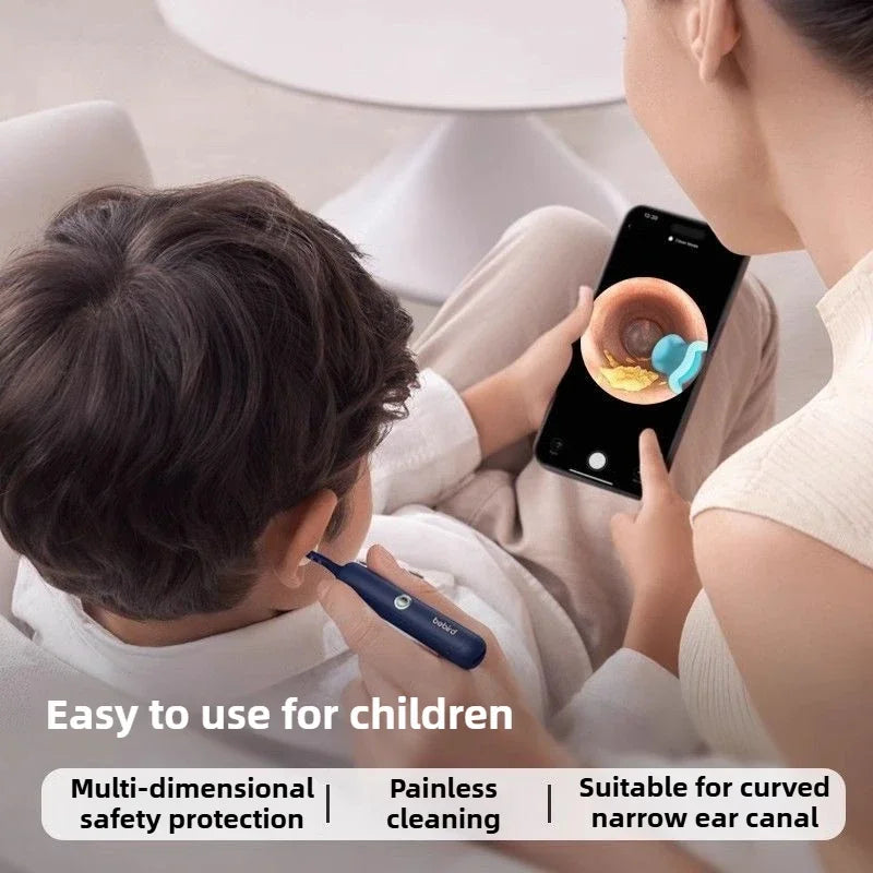 Xiaomi Bebird भिजुअल इयर क्लीनर HD क्लिपेबल ट्वीजर इयर पिकर वायरलेस क्लिनिङ एन्डोस्कोप क्यामेरा सहितको होम भिजुअल इयर स्कूप